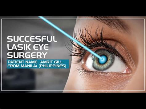 Durst Bedeutungslos Symbol Eye Laser Philippines Petroleum K Fer M Nze