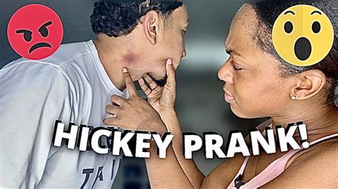 Hickey Prank On My Girlfriend 😳 Youtube