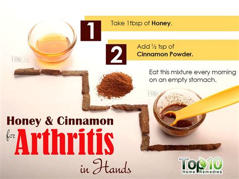 Home Remedies For Arthritis In Hands Top 10 Home Remedies