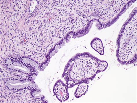 Cuello de útero histología normal Se observa el epitelio Flickr