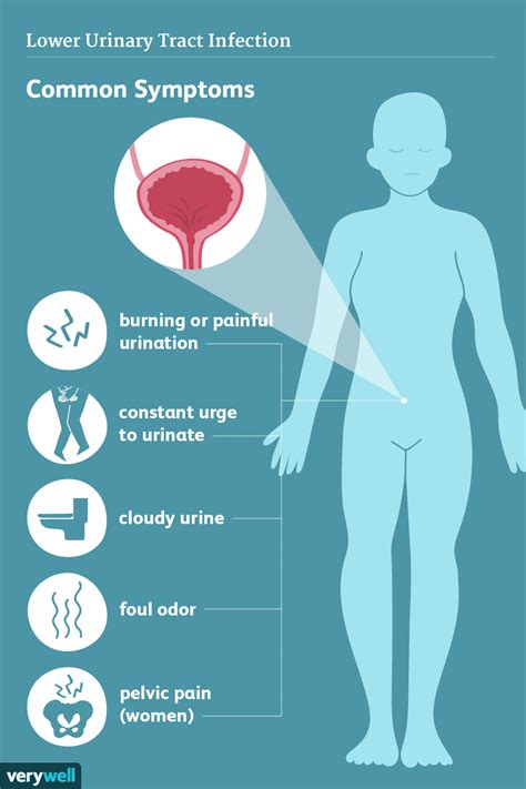 Infections des voies urinaires Symptômes et complications