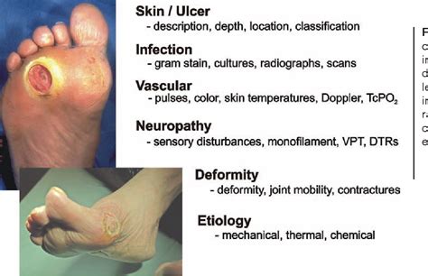 Figure 3 From Diabetic Foot Disorders A Clinical Practice Guideline 2006 Revision Semantic