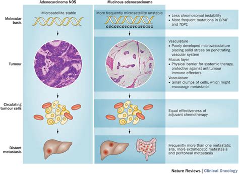 Mucinous Colorectal Cancer Esmo