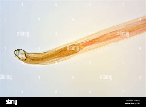 Ancylostoma Is An Human Intestinal Parasitic Roundworm Optical