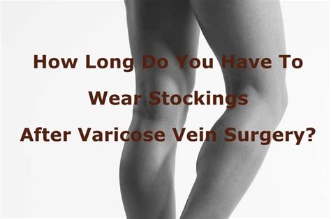 How Do Stockings For Varicose Veins Help You Karishma