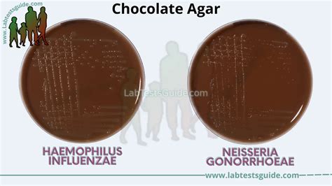 Chocolate Agar Composition Preparation And Uses Lab Tests Guide