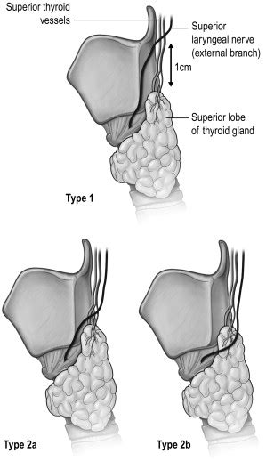 The Thyroid Gland Oncohema Key