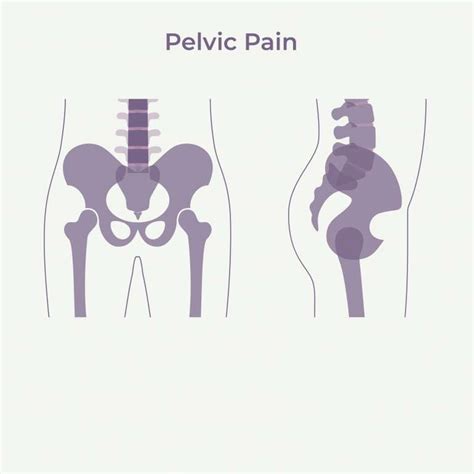 Pelvic Pain West Sussex Gynaecology