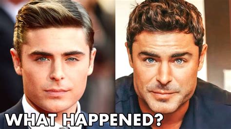 Zac Efron New Face Why He Looks So Different2021 Plastic