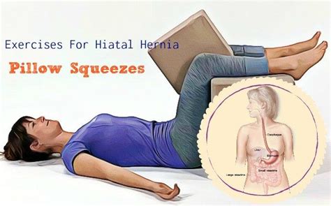 16 Safe Exercises For Hiatal Hernia To Follow Hernia Exercises Safe