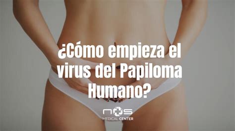 C Mo Empieza El Virus Del Papiloma Humano Nos Medical Center