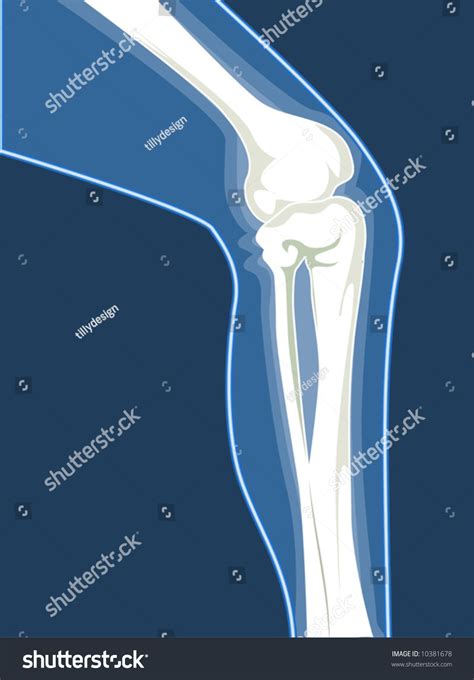 Human Leg Bones Stock Vector Illustration 10381678 Shutterstock