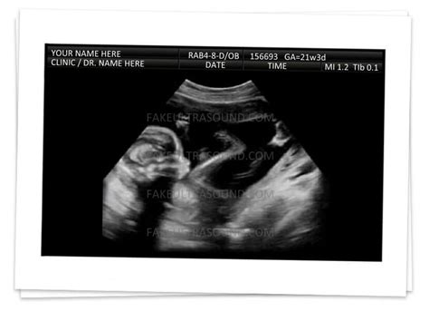 set of 2 prank ultrasound images fake ultrasound