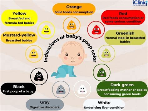 White Curds In Baby Poop Common Causes And When To Worry 52 Off