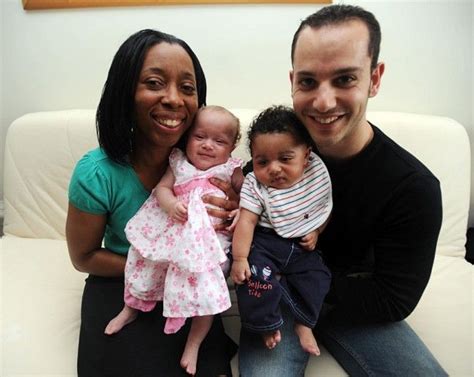 Pictured The Black And White British Twins Born At Odds Of A Million