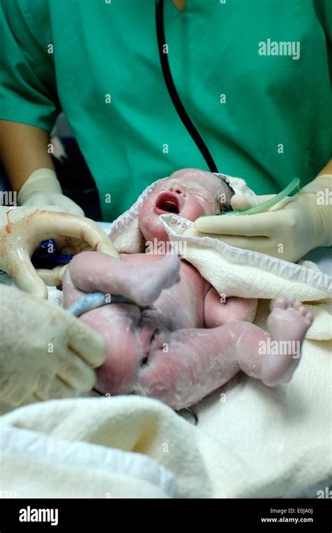 Los médicos y cirujanos ayudar bebé recién nacido para tomar la primera