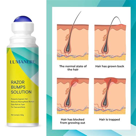 Lumanere Razor Bumps Solution + Hair Inhibitor After Shave Serum | Roll