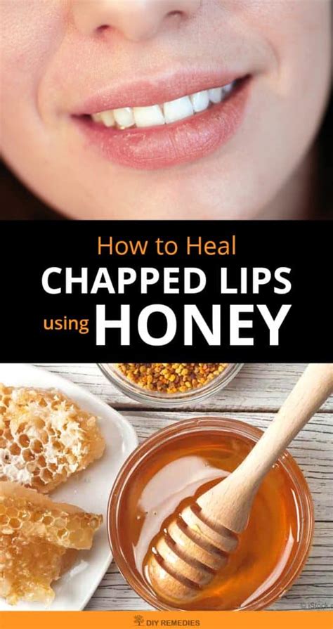 How To Heal Chapped Lips Using Honey