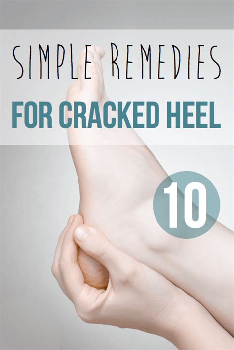 10 Simple Remedies For Cracked Heel