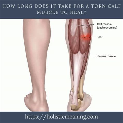 How Long Does It Take For A Torn Calf Muscle To Heal Holistic Meaning