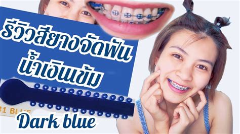 รีวิวสียางจัดฟันสีน้ำเงินเข้ม สีฮิตตลอดกาล ทั้งผู้หญิงผู้ชาย คุยเฟื่องเรื่องจัดฟัน Ep 18 Youtube