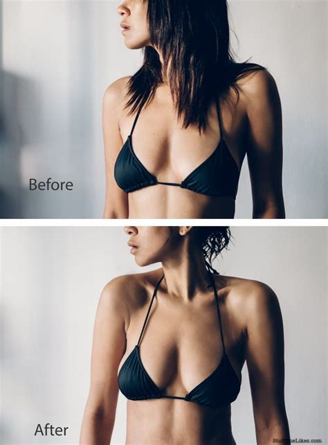 People with a lack of upper breast tissue 2. Pin on Breast Augmentation