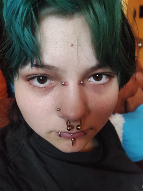 How To Get Rid Of Bridge Piercing Bumps I Tried Literally Everything And I Really Dont Want To