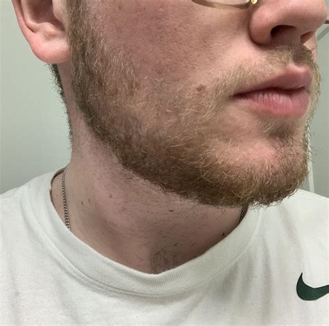 1 Month Beard Growth First Time Rbeards