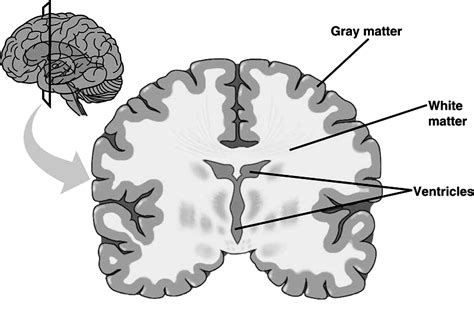 1 A Schematic Drawing Of The Human Brain Indicating The Two Main
