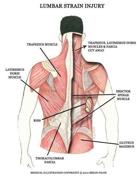 What is the part of his everyday work? 24 Best Back Muscle Strain Treatment Images On Pinterest ...