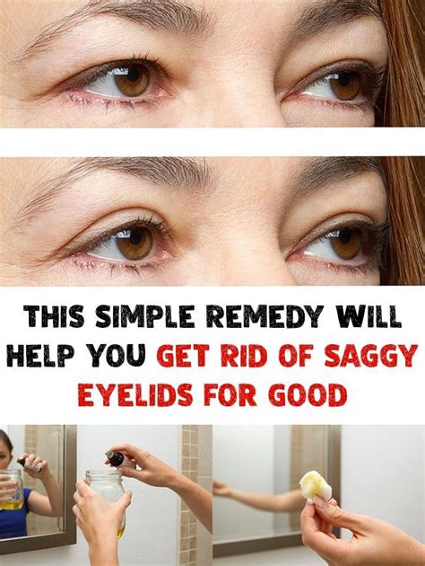 This Simple Remedy Will Help You Get Rid Of Saggy Eyelids For Good