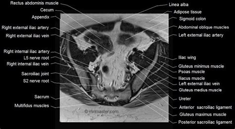Mri Female Pelvis Anatomy Axial Image Pelvis Anatomy Pelvis Rectus Abdominis Muscle