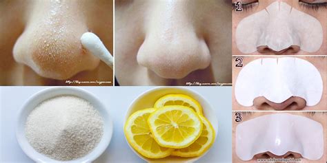 3 Steps Home Remedy To Remove Blackheads On Nose Life With Styles