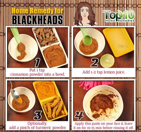 Home Remedies To Get Rid Of Blackheads Fast Top 10 Home Remedies