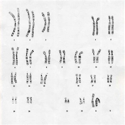 Hisashi Ouchi Karyotype