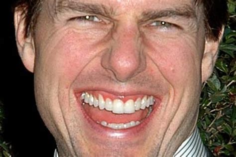 Tom Cruise Zähne Celebrities Who Received Cosmetic Dentistry