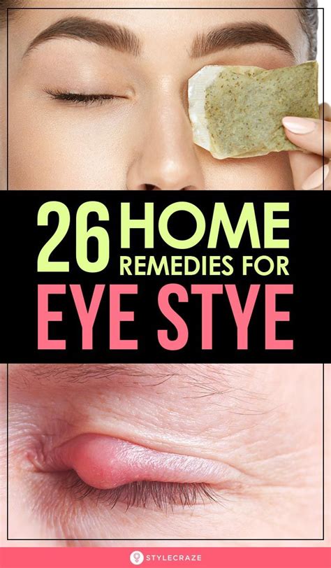 26 Effective Home Remedies To Get Rid Of Eye Stye Sty In Eye Remedies Eye Stye Remedies