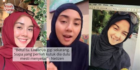 Bila berlaku mudah jer kan. VIDEO Viral Dikutuk 9 Tahun Gigi Rongak, Wanita Ini ...
