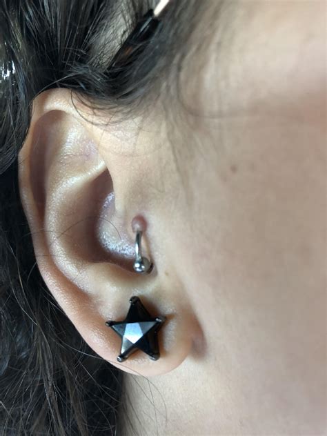Had Tragus Pierced About 2 2 12 Months Ago What Should I Putdo On My