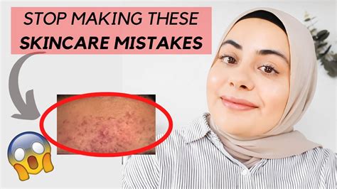 5 Skincare Mistakes That Could Be Making Your Acne Worse Acne