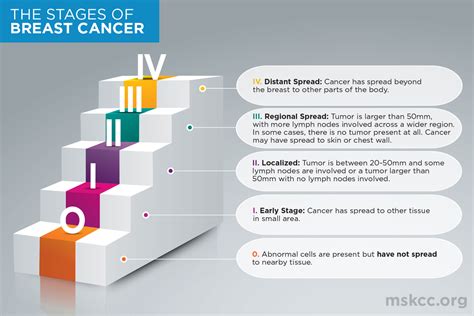 Breast Cancer Stages 0 1 2 3 And 4 Memorial Sloan Kettering Cancer Center