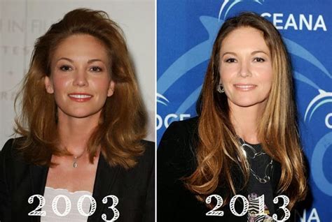 Diane Lane Plastic Surgery Facelift Breast Implants And Botox