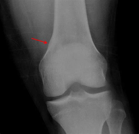 Msk Radiograph Case 17