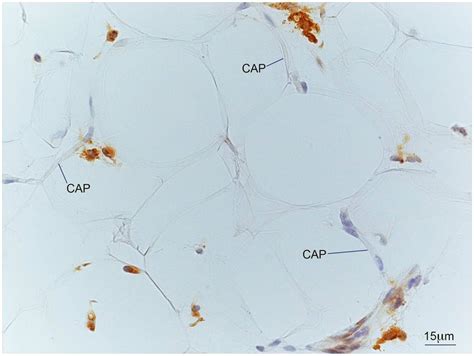 Light Microscopy Of Subcutaneous Adipose Tissue Sat Of An Obese