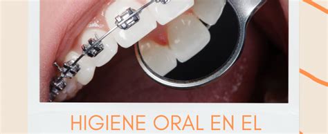 Higiene Oral En El Paciente De Ortodoncia Revista Avances En Higiene