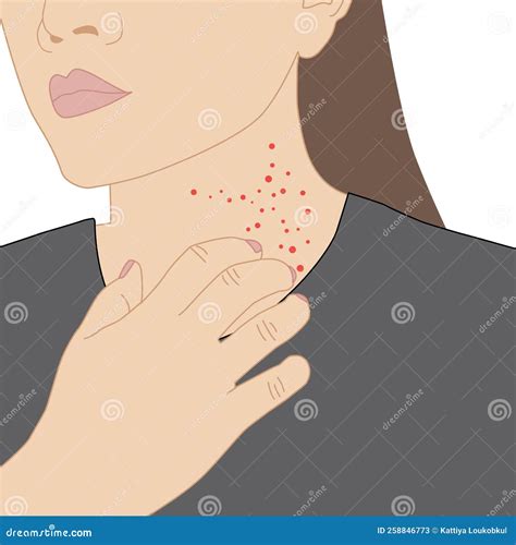Women Scratch The Rash Neck Itch Because Of Allergies Symptoms Or