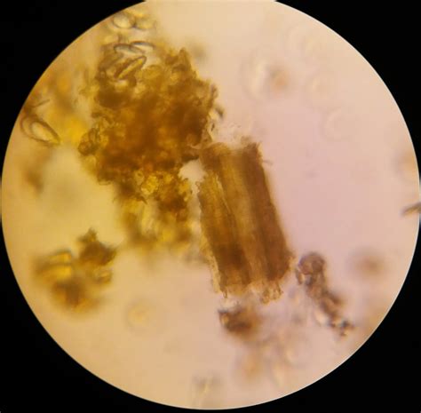 Maybe you would like to learn more about one of these? CURCUMAE DOMESTICAE RHIZOMA | F.NOSI MIKROSKOPIS