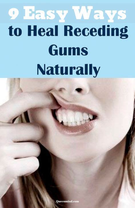 Easy Ways To Heal Receding Gums Naturally Teeth Health Gum Health