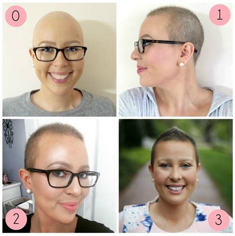 Most people who end up losing their hair find that it starts falling out two to four weeks after the first infusion. Hair Growth After Chemo 6 Months - These Will Be the 10 ...