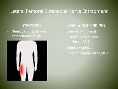 Femoral Cutaneous Nerve Entrapment